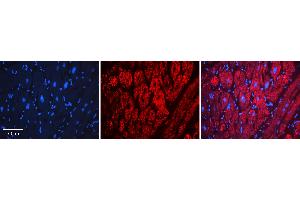 Rabbit Anti-LSS Antibody   Formalin Fixed Paraffin Embedded Tissue: Human heart Tissue Observed Staining: Cytoplasmic Primary Antibody Concentration: N/A Other Working Concentrations: 1:600 Secondary Antibody: Donkey anti-Rabbit-Cy3 Secondary Antibody Concentration: 1:200 Magnification: 20X Exposure Time: 0.