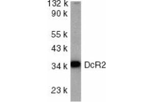 Image no. 1 for anti-Tumor Necrosis Factor Receptor Superfamily, Member 10d, Decoy with Truncated Death Domain (TNFRSF10D) (AA 249-263) antibody (ABIN201906) (DcR2 antibody  (AA 249-263))