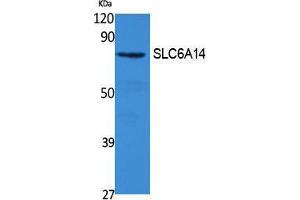 Western Blotting (WB) image for anti-Solute Carrier Family 6 (Amino Acid Transporter), Member 14 (Slc6a14) (C-Term) antibody (ABIN3187658) (Slc6a14 antibody  (C-Term))