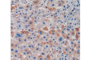 Used in DAB staining on fromalin fixed paraffin- embedded liver tissue (PAD4 antibody  (AA 1-300))