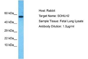 Host: Rabbit Target Name: SOHLH2 Sample Type: Fetal Lung lysates Antibody Dilution: 1. (SOHLH2 antibody  (N-Term))
