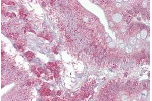 Anti-PSEN1 / Presenilin 1 antibody IHC staining of human small intestine. (Presenilin 1 antibody  (AA 300-349))