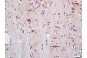 Formalin-fixed and paraffin embedded mouse brain labeled with Anti-IL-17RC Polyclonal Antibody, Unconjugated  at 1:200 followed by conjugation to the secondary antibody and DAB staining. (IL17RC antibody  (AA 151-250))