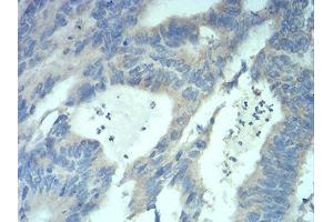 Immunohistochemistry (IHC) image for anti-Methyl CpG Binding Protein 2 (MECP2) (AA 7-148) antibody (ABIN5889789) (MECP2 antibody  (AA 7-148))