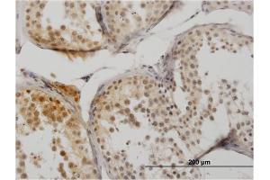 Immunoperoxidase of monoclonal antibody to SUMO1 on formalin-fixed paraffin-embedded human testis. (SUMO1 antibody  (AA 1-101))