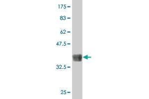 Western Blot detection against Immunogen (37. (MAP3K11 antibody  (AA 741-847))