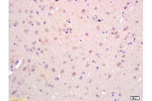 Formalin-fixed and paraffin embedded rat brain labeled with Rabbit Anti EphA2/Eph receptor A2 Polyclonal Antibody, Unconjugated (ABIN669201) at 1:200 followed by conjugation to the secondary antibody and DAB staining (EPH Receptor A2 antibody  (AA 901-976))