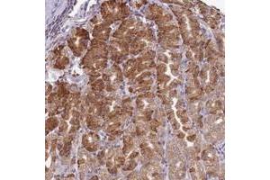 Immunohistochemical staining of human stomach with SCAF1 polyclonal antibody  shows strong cytiplasmic positivity in glandular cells at 1:50-1:200 dilution. (SCAF1 antibody)