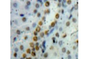 IHC-P analysis of Kidney Tissue, with DAB staining. (HMGB1 antibody  (AA 1-215))