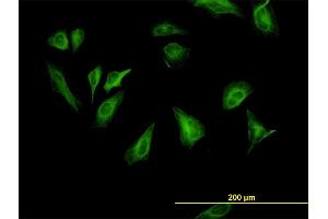Immunofluorescence (IF) image for anti-Ribosomal Protein S6 Kinase, 70kDa, Polypeptide 1 (RPS6KB1) (AA 416-525) antibody (ABIN562721)