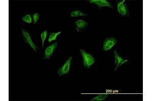 Immunofluorescence of monoclonal antibody to RPS6KB1 on HeLa cell. (RPS6KB1 antibody  (AA 416-525))