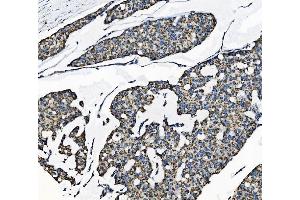 IHC analysis of TOMM70 using anti-TOMM70 antibody (ABIN7599855). (TOM70 antibody  (AA 122-608))