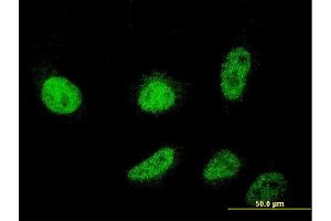 Immunofluorescence of monoclonal antibody to CSDC2 on HeLa cell. (CSDC2 antibody  (AA 1-153))