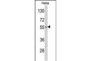 Western blot analysis of DFNA5 Antibody in Hela cell line lysates (35ug/lane) (DFNA5 antibody  (N-Term))