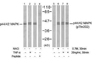 Image no. 1 for anti-Mitogen-Activated Protein Kinase 1/3 (MAPK1/3) (Thr202) antibody (ABIN197484) (ERK1/2 antibody  (Thr202))