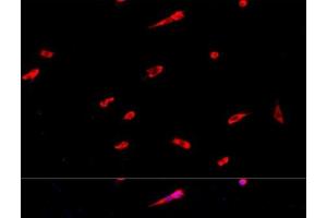 Immunofluorescence analysis of PC-12 cells using EIF3J Polyclonal Antibody at dilution of 1:100. (EIF3S1 antibody)