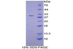 SDS-PAGE (SDS) image for Integrin alpha D (ITGAD) (AA 886-1106) protein (His tag) (ABIN2125321) (ITGAD Protein (AA 886-1106) (His tag))
