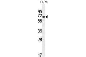 AMY2B Antibody (N-term) western blot analysis in CEM cell line lysates (35µg/lane). (AMY2B antibody  (N-Term))