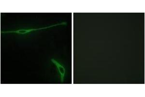 Immunofluorescence analysis of NIH-3T3 cells, using LAMA2 Antibody. (Laminin antibody  (AA 2011-2060))