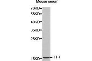 Western Blotting (WB) image for anti-Transthyretin (TTR) antibody (ABIN1875226) (TTR antibody)