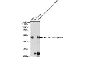 Immunoprecipitation analysis of 300 μg extracts of 293T cells using 3 μg SARS-CoV-2 Nucleoprotein antibody (ABIN7269053). (SARS-CoV-2 Envelope antibody)