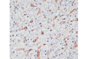 Immunohistochemistry of paraffin-embedded Human liver using CD36 Polyclonal Antibody at dilution of 1:200 (40x lens). (CD36 antibody)