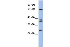 WB Suggested Anti-ATP6V1A Antibody Titration: 0. (ATP6V1A antibody  (N-Term))
