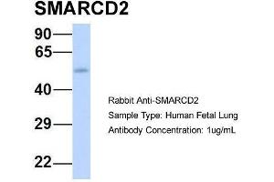 Host:  Rabbit  Target Name:  SMARCD2  Sample Type:  Human Fetal Lung  Antibody Dilution:  1.