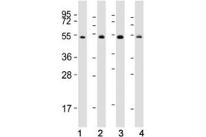 Western blot testing of human 1) Raji, 2) K562, 3) Jurkat and 4) HeLa cell lysate with HSP60 antibody. (HSPD1 antibody  (AA 80-109))