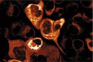 Immunofluorescence staining of A431 cells. (Kalinin B1 (AA 1009-1170) antibody)