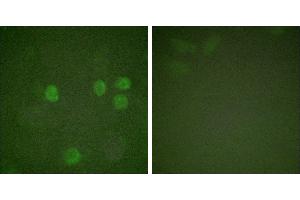 Forskolin + -Immunofluorescence analysis of HeLa cells, treated with Forskolin (40nM, 30mins), using Cyclin B1 (Ab-126) antibody (#BOO68). (Cyclin B1 antibody  (Ser126))