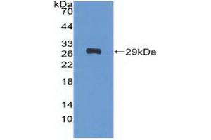 Detection of Recombinant PDGFRa, Human using Polyclonal Antibody to Platelet Derived Growth Factor Receptor Alpha (PDGFRa) (PDGFRA antibody  (AA 170-387))