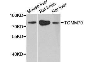 Western blot analysis of extracts of various cell lines, using TOMM70 antibody (ABIN1875156) at 1:1000 dilution. (TOM70 antibody)
