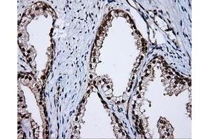 Immunohistochemical staining of paraffin-embedded Kidney tissue using anti-APP mouse monoclonal antibody. (APP antibody)