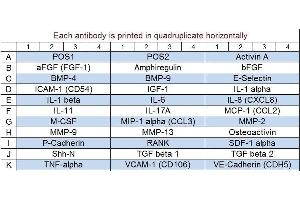 Image no. 1 for Human Bone Metabolism Array Q1 (ABIN4956024)