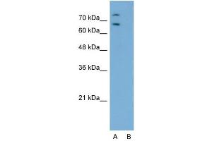 Host:  Rabbit  Target Name:  RORA  Sample Type:  Jurkat  Lane A:  Primary Antibody  Lane B:  Primary Antibody + Blocking Peptide  Primary Antibody Concentration:  2.