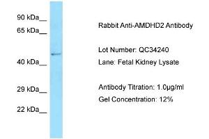 Host: Rabbit Target Name: AMDHD2 Sample Type: Fetal Kidney Antibody Dilution: 1. (AMDHD2 antibody  (N-Term))