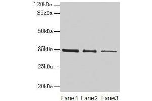 Western blot All lanes: GDF15 antibody at 4 μg/mL Lane 1: HepG2 whole cell lysate Lane 2: Human placenta tissue Lane 3: A549 whole cell lysate Secondary Goat polyclonal to rabbit IgG at 1/10000 dilution Predicted band size: 35 kDa Observed band size: 35 kDa (GDF15 antibody  (AA 198-308))