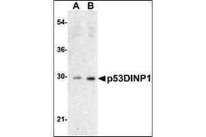 Western blot analysis of TP53INP1 expression in Human lung tissue lysate with AP30639PU-N TP53INP1 antibody at 0. (TP53INP1 antibody  (N-Term))