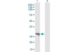 Western Blotting (WB) image for anti-Cytochrome P450, Family 3, Subfamily A, Polypeptide 4 (CYP3A4) (AA 1-280) antibody (ABIN528717)