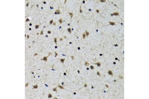 Immunohistochemistry of paraffin-embedded rat brain using SLC23A2 antibody (ABIN2559957) at dilution of 1:100 (40x lens). (SLC23A2 antibody)