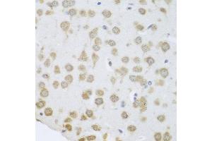Immunohistochemistry of paraffin-embedded mouse brain using GRPEL2 antibody at dilution of 1:100 (40x lens). (GRPEL2 antibody)