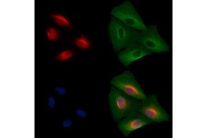ABIN7094643 and ABIN7098693 staining  cells by IF/ICC.