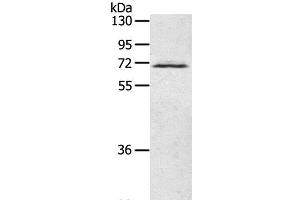 Western Blot analysis of Human fetal brain tissue using LTA4H Polyclonal Antibody at dilution of 1:500 (LTA4H antibody)
