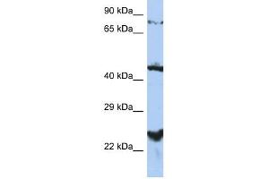 MRS2L antibody used at 1 ug/ml to detect target protein. (MRS2 antibody  (Middle Region))