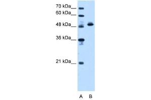 ATP5B antibody used at 1.