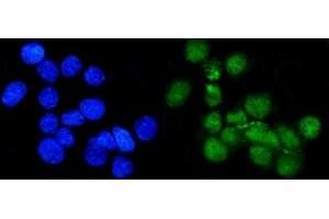 IF analysis of METTL1 using anti-METTL1 antibody (ABIN7600484).