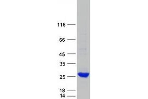 FTHL17 Protein (Myc-DYKDDDDK Tag)