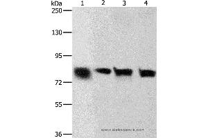 Western blot analysis of Hela and A549 cell, human liver cancer tissue and HT-29 cell, using CDH6 Polyclonal Antibody at dilution of 1:500