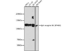 Western blot analysis of extracts of various cell lines, using Eph receptor B3 (EPHB3) (EPHB3) antibody (ABIN7266972) at 1:1000 dilution. (EPH Receptor B3 antibody)